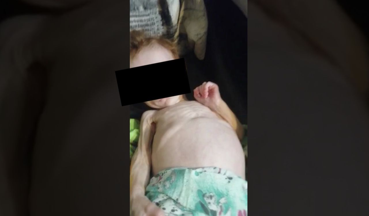 Девочка из Карпинска, которую мать держала в шкафу, переведена из реанимации в обычную палату