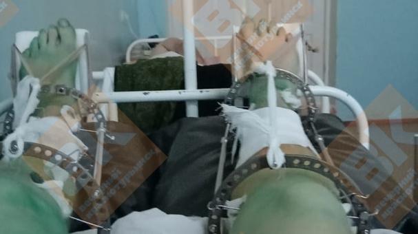 «Потребуется несколько операций»: жена пострадавшего в шахте горняка рассказала о ЧП
