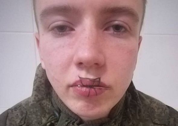 Солдат-срочник из Североуральска после ссоры с девушкой зашил себе рот 