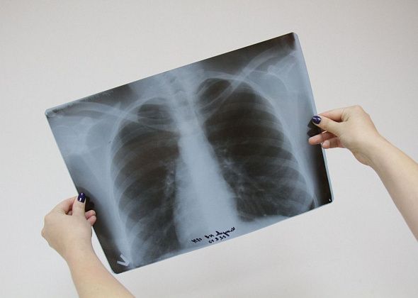 Жители Кошая, Романово, Пасынка и Маслова могут пройти обследование на передвижном флюорографе